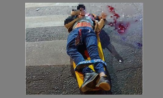 Quilmes – Accidente fatal, un motociclista muerto y otro herido de gravedad